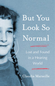 cover of but you look so normal